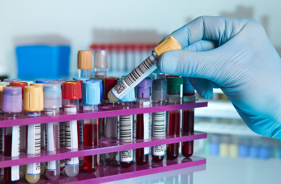 LOS COLORES DE LA SANGRE